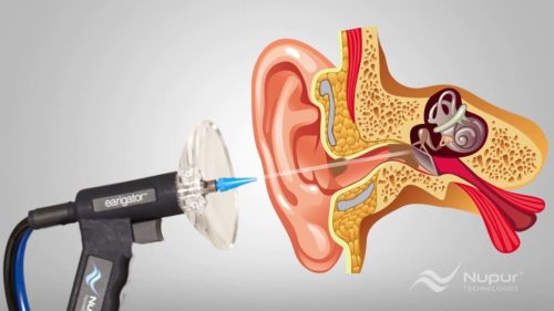 Hearing Aids Simpsonville Sc Sound Hearing 4 6 2026 5