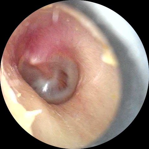 hearing-aids-simpsonville-sc-sound-hearing-2-2-2026-6