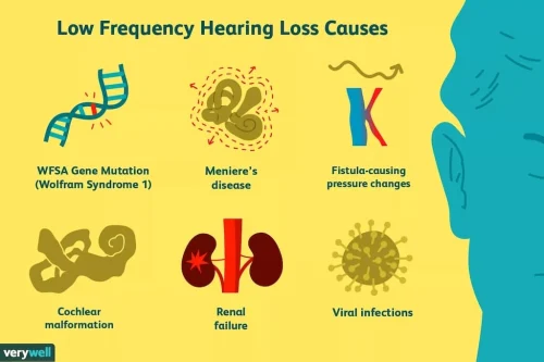 hearing-aids-simpsonville-sc-sound-hearing-6-8-2026-5