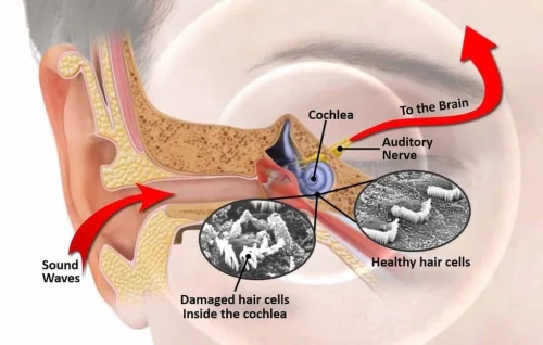 hearing-aids-simpsonville-sc-sound-hearing-6-8-2026-6